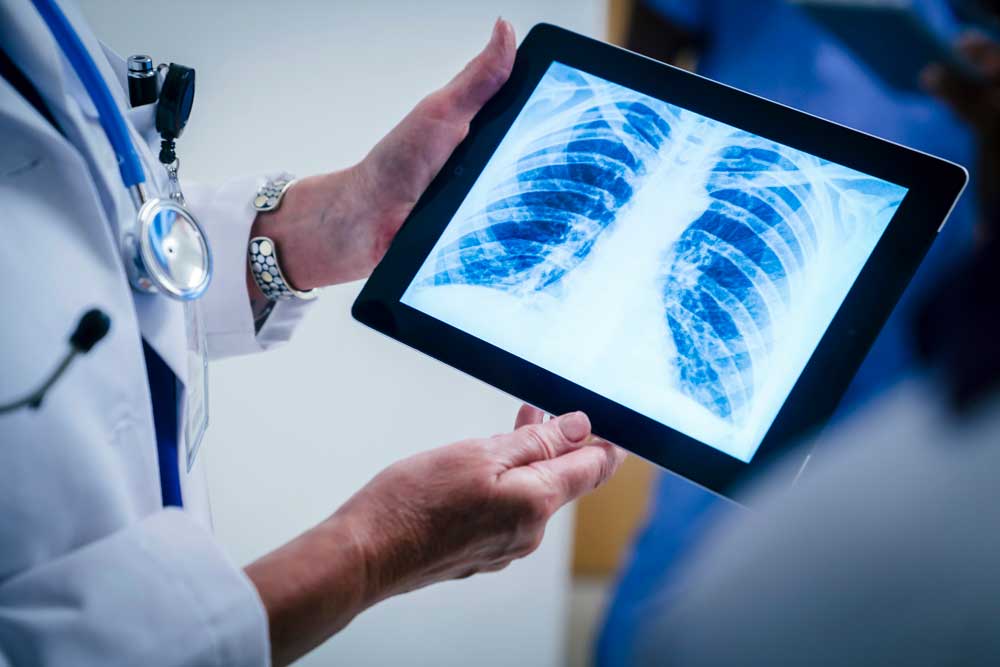 Doctor holding image of chest xray 2