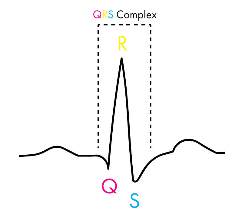 QRS complex 3 6