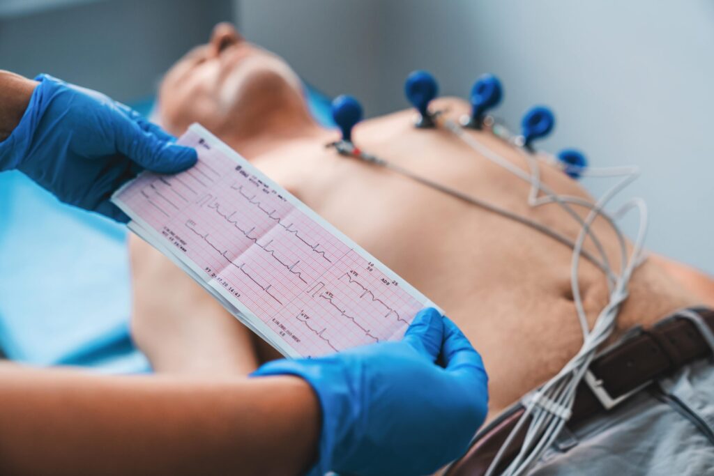 eletrocardiograma ecg scaled 1 1024x683 1 1